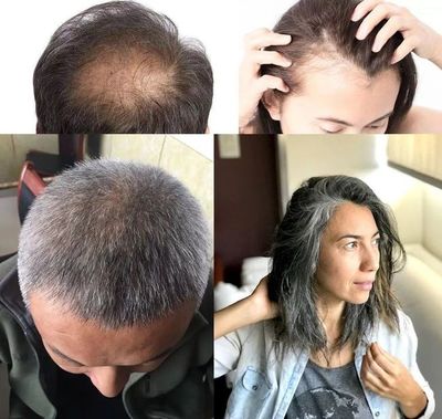 洗頭水中撒一把，頭發(fā)長得又快又茂密，白發(fā)都沒了！